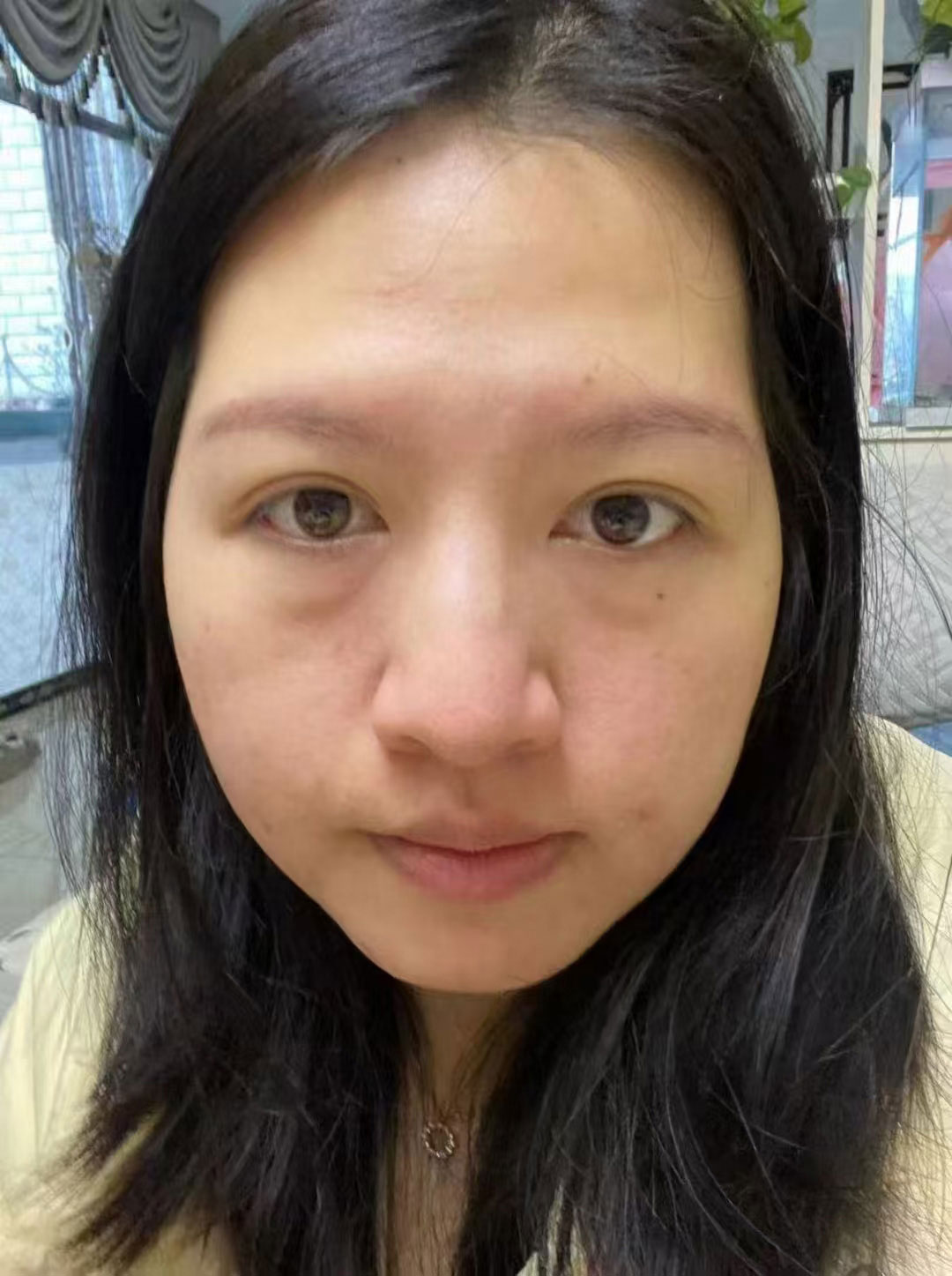 前后对比