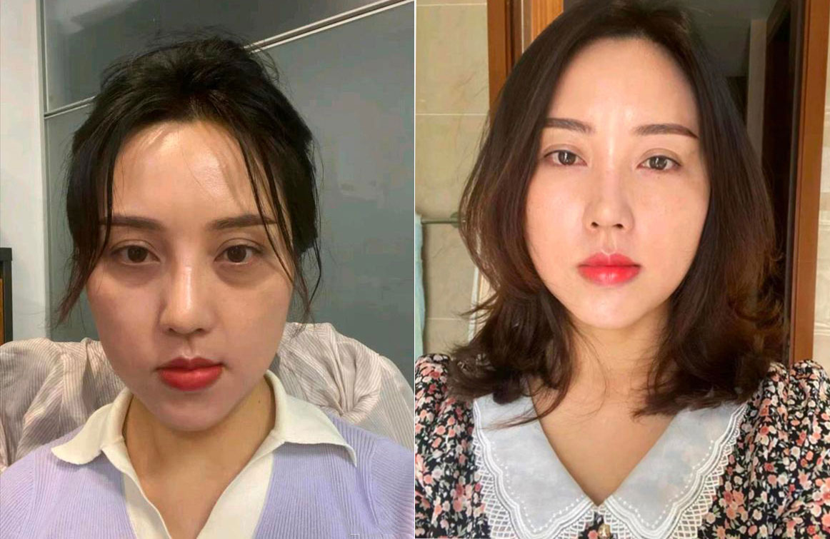 前后对比