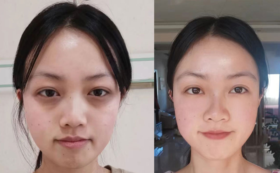 前后对比
