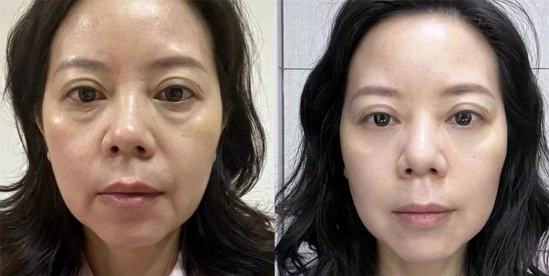 前后对比